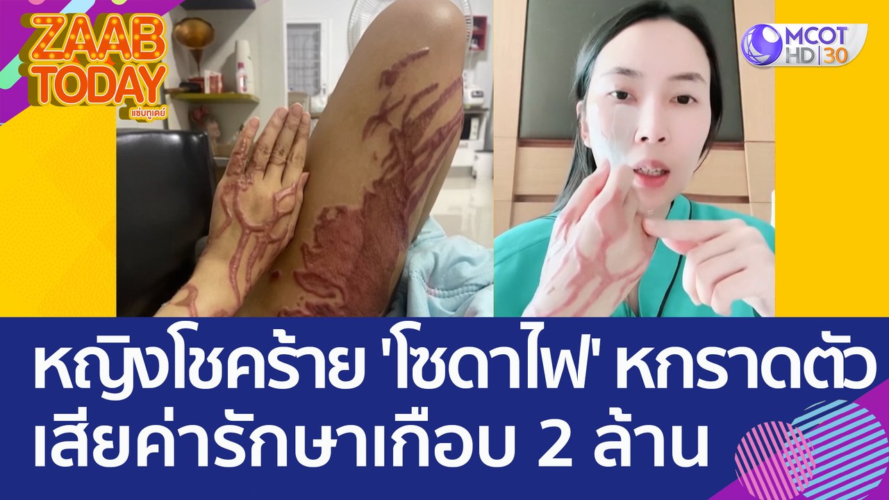 อุทาหรณ์! หญิงโชคร้าย ถูก 'โซดาไฟ' หกราดตัว เสี...