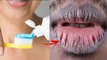 ToothPaste से Lips Dry कैसे होते हैं | गर्मी में होंठ सूखने का कारण | Boldsky