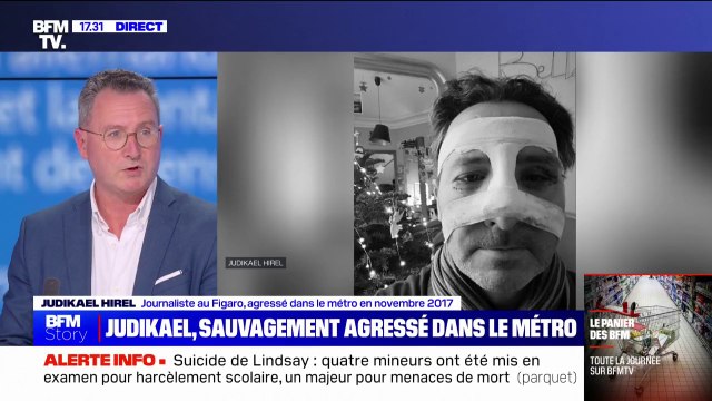 Violences: Je suis passé à un ou deux coups de pied dans la tête du cimetière , le témoignage de Judikael Hirel, agressé dans le métro parisien