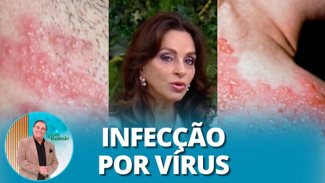 Herpes: Saiba as causas, sintomas e tratamentos para cada tipo