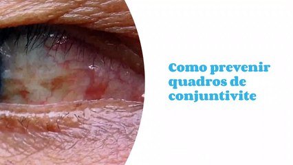 Como prevenir quadros de conjuntivite
