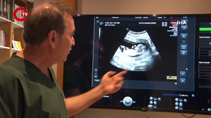 'Gebelikte her balığın eti yenmez' uyarısı