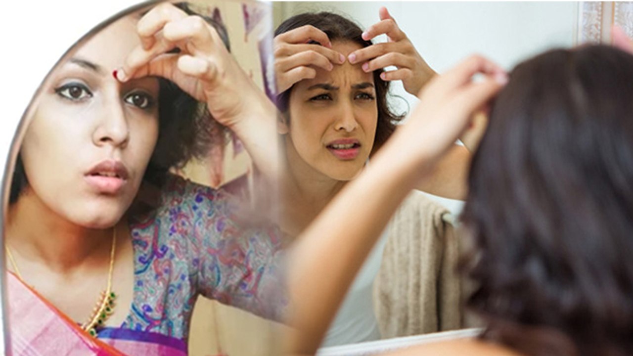 Bindi Allergy Home Remedies: बिंदी को लगाने से होती है खुजली तो क्या करें | Boldsky