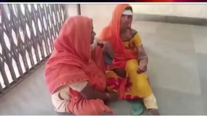 हैवानियत: बहू को गर्म पानी से जलाते थे ससुरालीजन, चिल्लाती तो मुंह में ठूंस देते थे कपड़ा, फिर ...