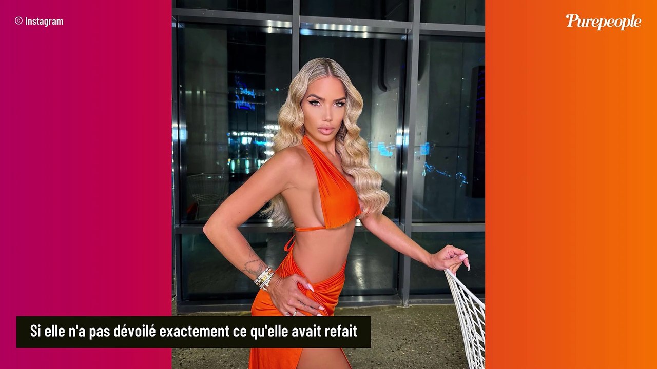 "J'avais des creux" : Photo du corps nu de Manon Marsault avant opération et après opération !