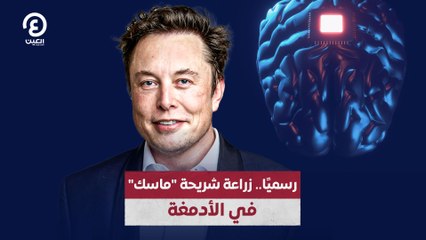 رسميًا.. زراعة شريحة "ماسك" في الأدمغة