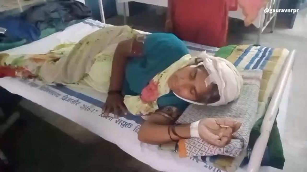 बिजनौर: जमीनी विवाद के चलते दो गुट भिड़े, जमकर चले लाठी डंडे, महिला घायल
