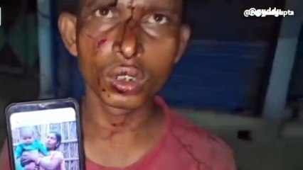 कटिहार: उधार मांगे जाने पर ससुराल वालों ने दामाद की कर दी पिटाई, देखें रिपोर्ट