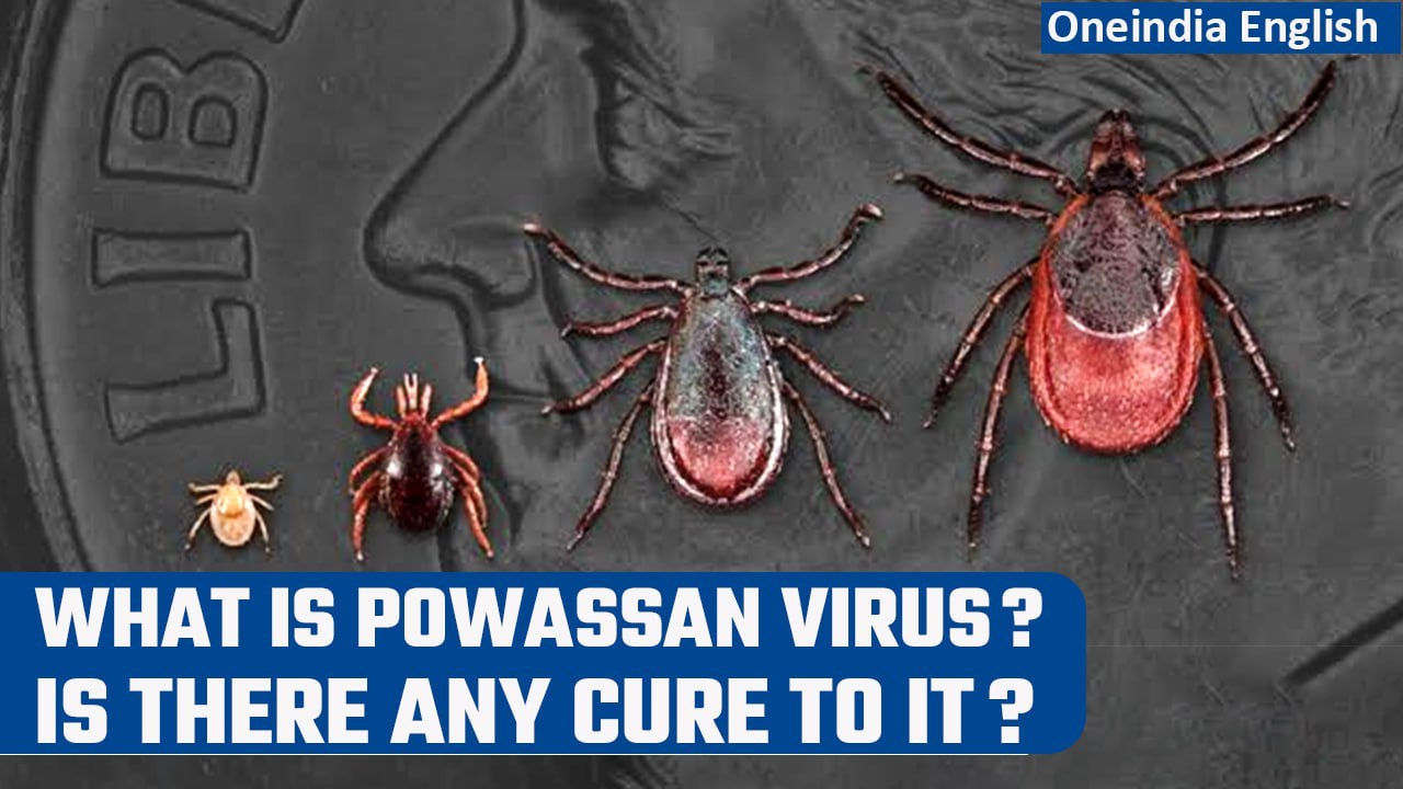 Powassan Virus: What is this rare and deadly vi...