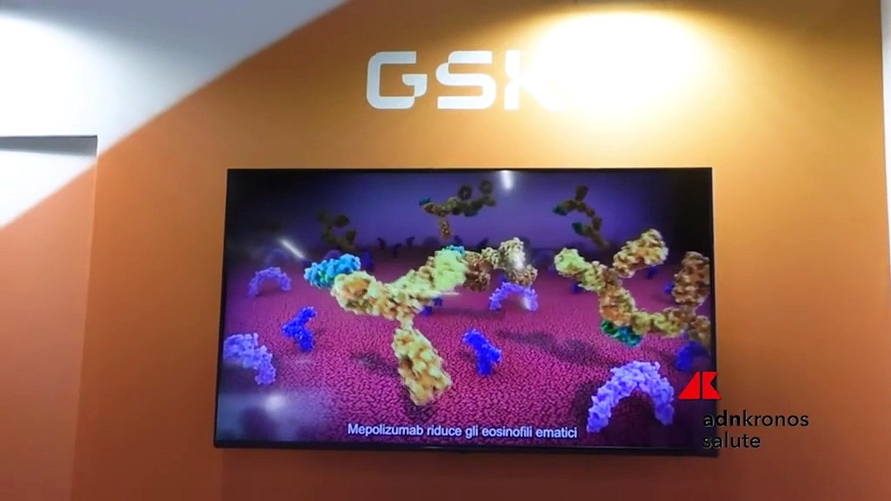 Da Gsk nuove frontiere trattamento rinosinusite cronica con poliposi nasale