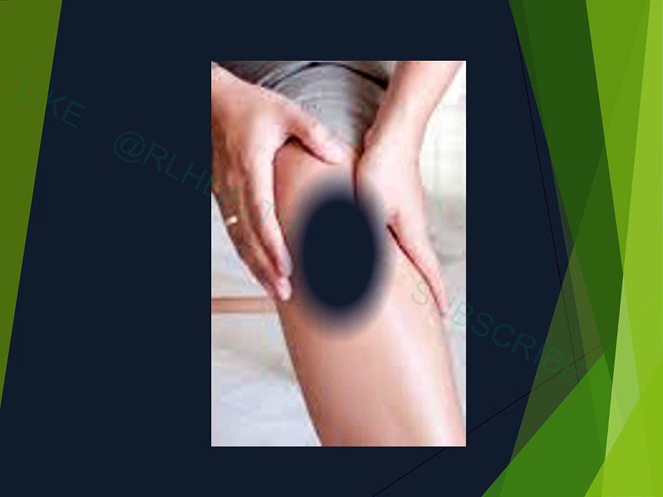 Knee joint grease. ghutno ki grease ka qadimi nuskha.  گھٹنوں کے لیس یا گریس کا قدیم نسخہ.. Knee joint grease.