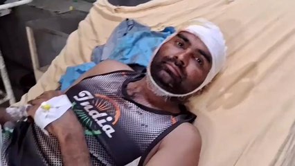 खौफ़नाक: दबंगों ने फोड़ा युवक का सिर, जान बचाने के लिए लगाए "35 टांके"