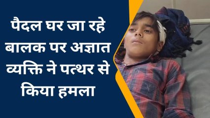 भीलवाड़ा: पैदल घर जा रहे बालक पर अज्ञात व्यक्ति ने पत्थर से किया हमला, इलाज जारी