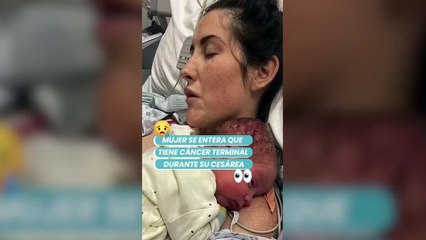 Médico llora en parto de paciente al descubrir en plena cesárea que mujer tenía cáncer terminal