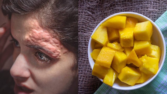 Aam Ka Achar Khane Se Kya Hota Hai | आम का अचार खाने से क्या होता है | Boldsky