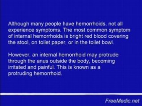 Hemorrhoids-treatment-symptoms-and-cure