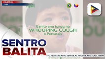 Outbreak ng Pertussis o Tuspirina, idineklara ng Quezon City LGU