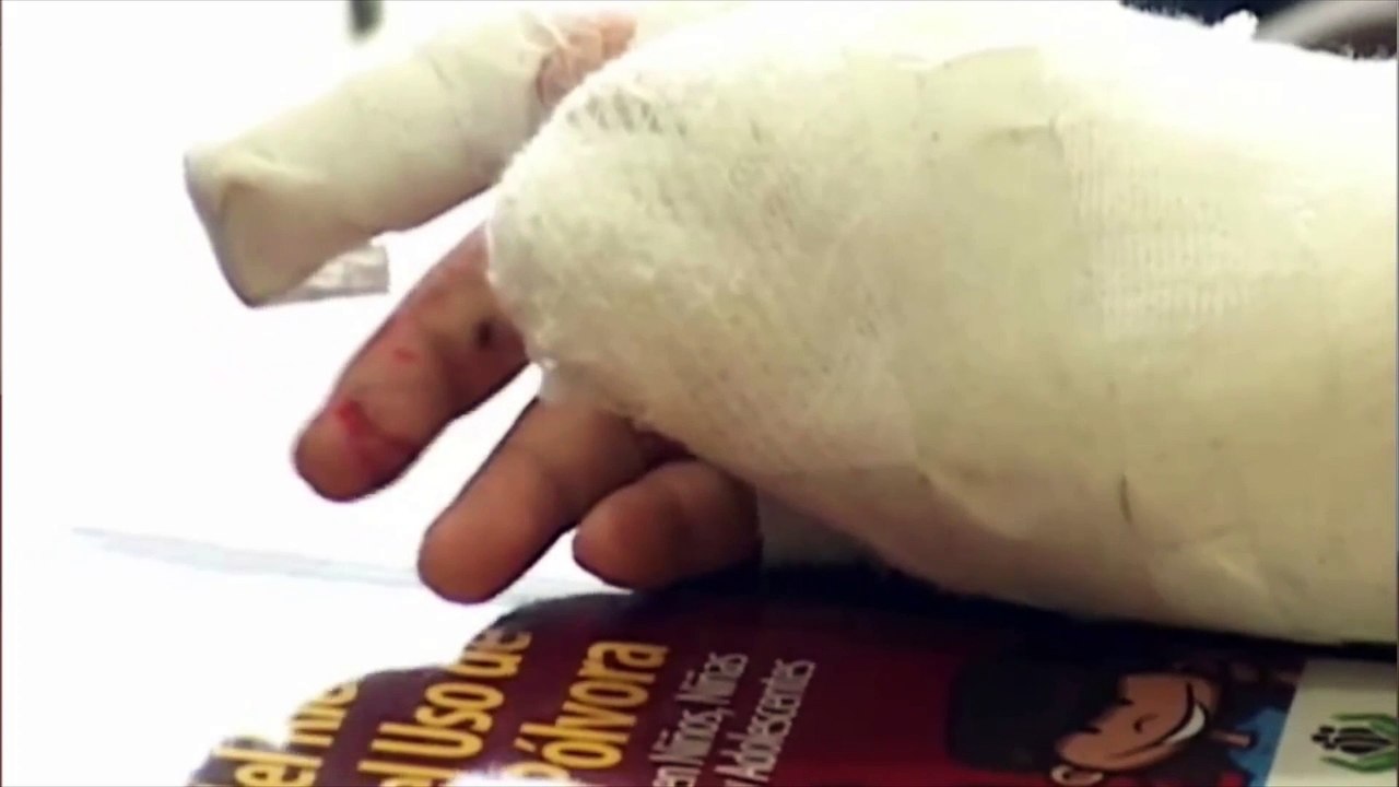 15-11-17 La polvora mata Contundente mensaje para evitar mas victimas este fin de ano