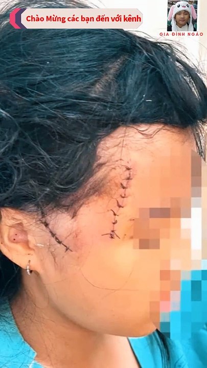 2 mẹ con bị người tình dùng dao chém trong đêm