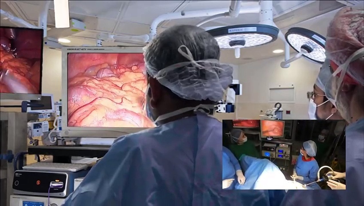 Bilateral Salpingo-oophorectomy for Ovarian Mass with Transvaginal Retrieval