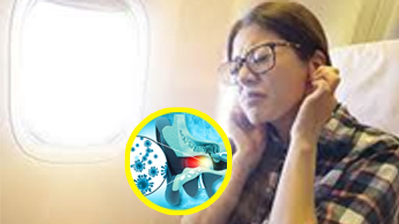 Ear Barotrauma Kya Hota Hai । Apko Uchai Me Ear Pain Hota Hai । Boldsky