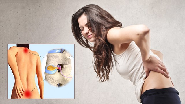 कमर के बाईं तरफ दर्द क्यों होता है | Kamar Ke Bai Taraf Dard Kyu Hota Hai | Boldsky