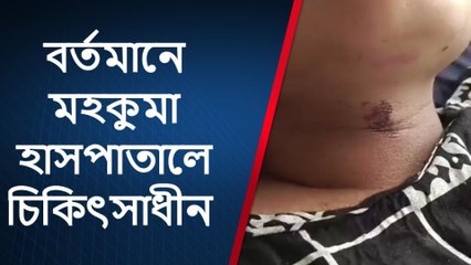 কোচবিহার: বউয়ের গলায় ওটা কিসের দাগ? শুনলে আঁৎকে উঠবেন