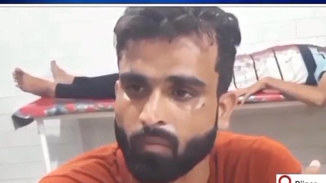 बिजनौर: नाली विवाद को लेकर दो पक्षों में 'छिड़ी खूनी जंग', कई लोग घायल
