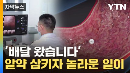 [자막뉴스] 불편했던 내시경, 알약 몇 알에...몸속에서 놀라운 기술 / YTN
