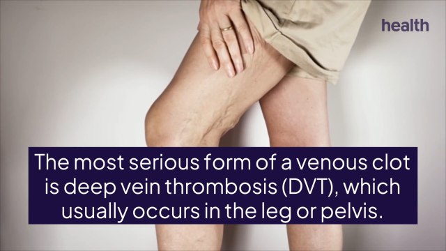 Blood Clot Symptoms: What To Watch For, and When To See a Healthcare Provider