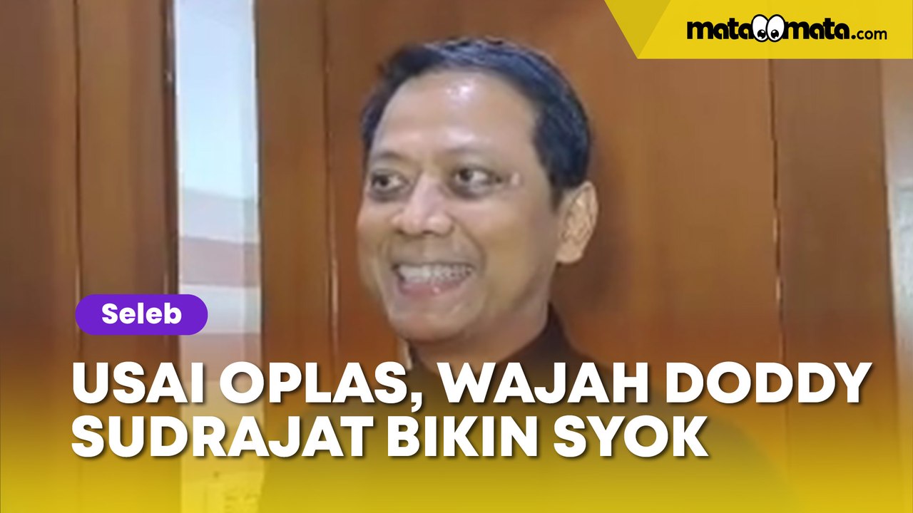 Wajah Doddy Sudrajat Usai Oplas Bikin Syok: Kayak Abis Digebuki Netizen