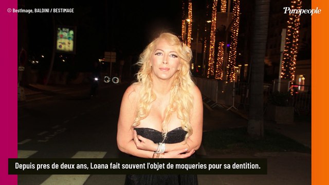 Loana, taxée d'édentée rétablit la vérité sur sa bouche : ll m'en reste quelques-unes quand même