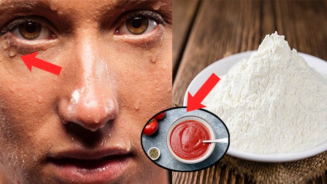 चेहरे पर ज्यादा पसीना आने पर क्या करें | Chehre Par Jyada Pasina Aane Par Kya Kare | Boldsky