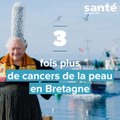 3 fois plus de cancers de la peau en Bretagne