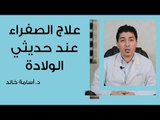 علاج الصفراء عند حديثى الولادة وأسبابها