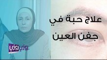 علاج حبة في جفن العين