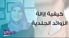 كيفية إزالة الزوائد الجلدية