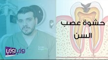 ما هي حشوة عصب السن؟