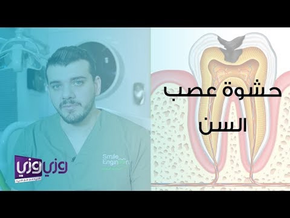 ما هي حشوة عصب السن؟