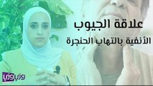 علاقة الجيوب الأنفية بالتهاب الحنجرة