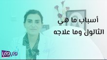 ما هي أسباب الثالول وما علاجه