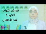 أعراض التهاب الكبد عند الأطفال