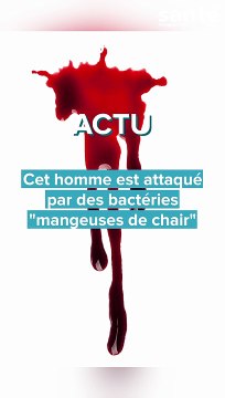 Un homme attaqué par des bactéries mangeuses de chair