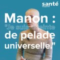 Manon : Je suis atteinte de pelade universelle