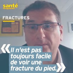Une fracture du pied peut-elle passer inaperçu ?