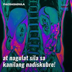 Mga doktor, may nakuha sa katawan ng lalaking 3 taon nang masakit ang tiyan | GMA News Feed