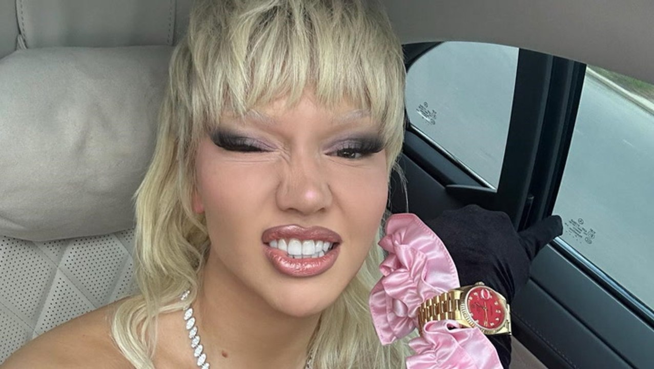 Nach Unfall: Shirin David gibt Update