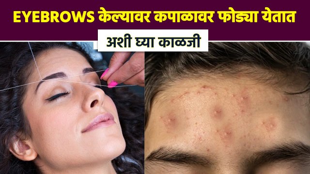 Eyebrows केल्यावर फोड्या येतात? 'या' steps follow करा | Easy Ways to Stop Breakouts After Threading
