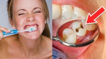 दांतो में कितनी देर तक ब्रश करना चाहिए | Toothbrush Kitni Der Tak Karna Chahiye | Boldsky