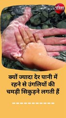 ज्यादा देर पानी में रहने से उंगलियों की चमड़ी क्यों सिकुड़ने लगती हैं ?